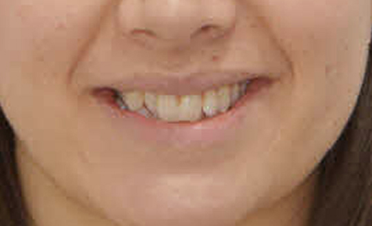 Sara antes